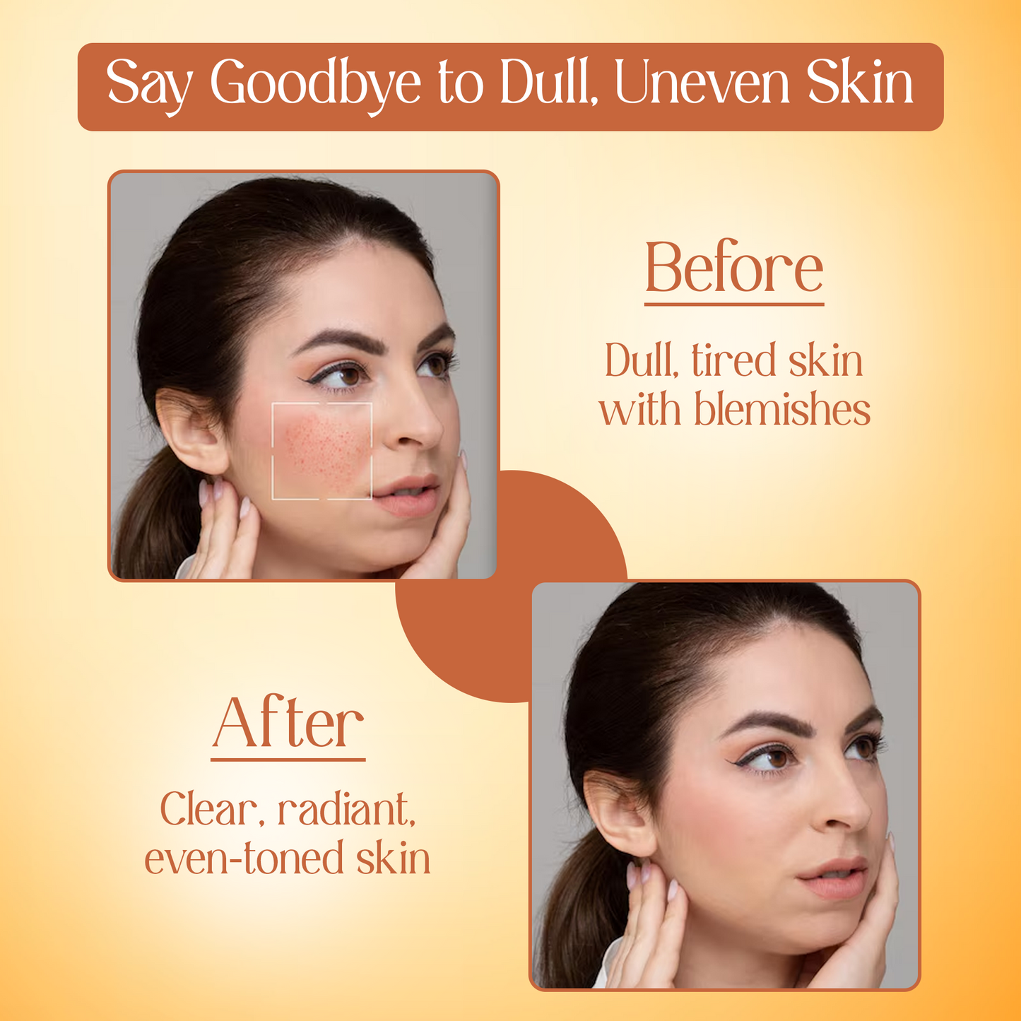 Vitamin C Turmeric Brightening Face Wash | Removes Dark Spots & Hyperpigmentation|