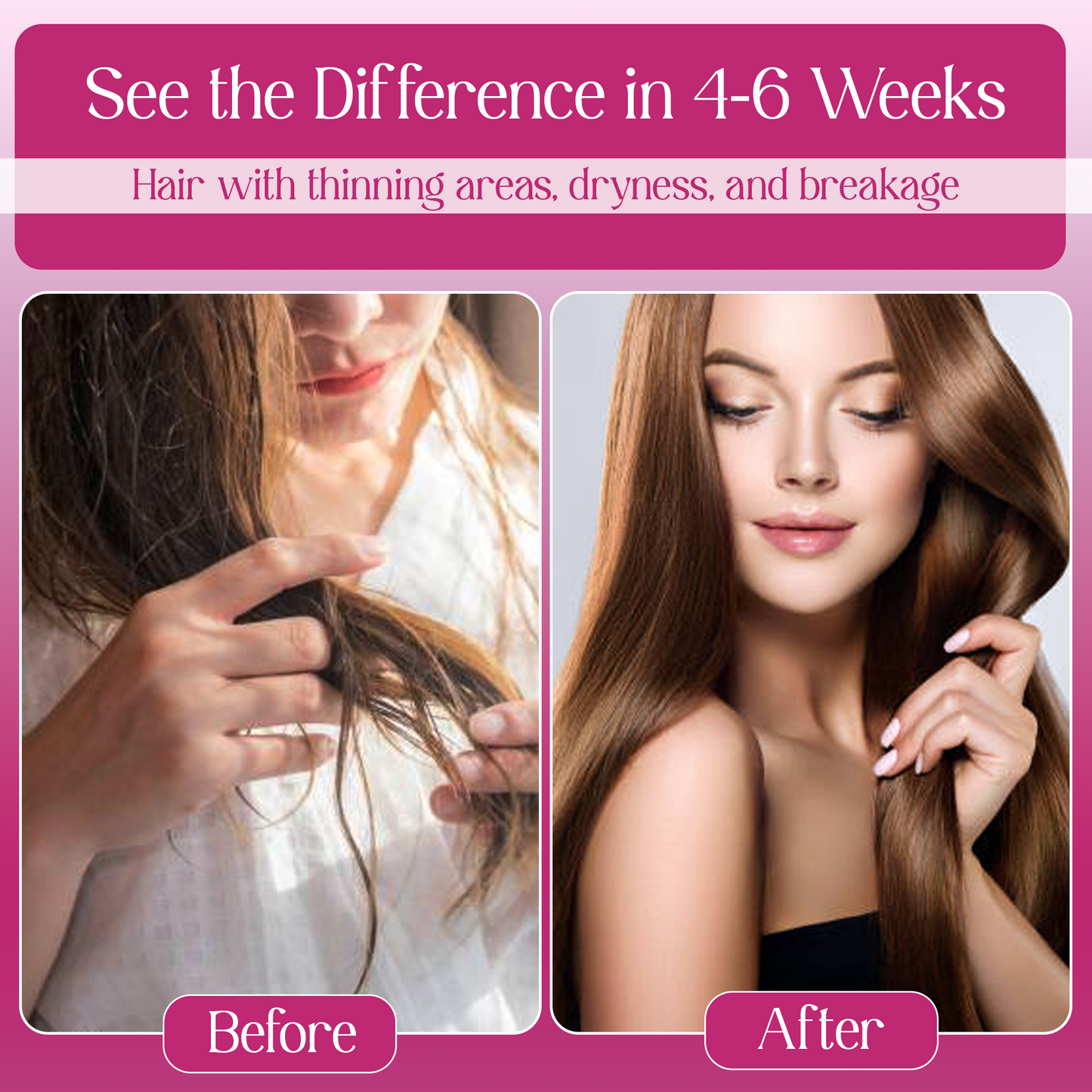 Rosemary Hair Oil | Best Hair Fall Control & Scalp Nourishment | Strengthens & Thickens Hair |