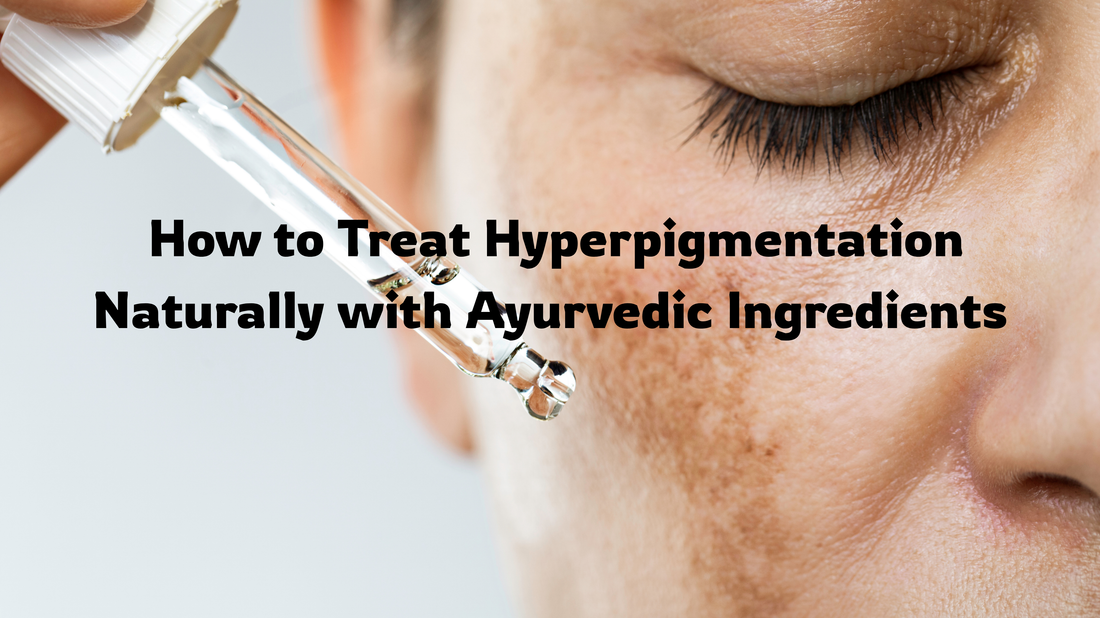 How to Treat Hyperpigmentation Naturally with Ayurvedic Ingredients