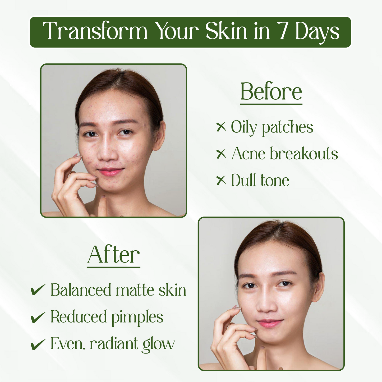 Charm N Glam Face Cleanser(Face wash) |Anti Acne Face Wash| 200ML