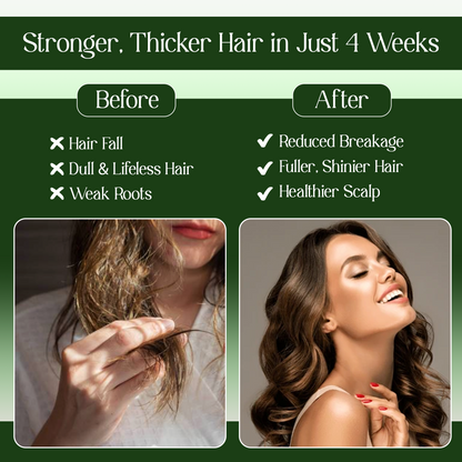 Bringha Anti Hair Fall Hair Cleanser (Shampoo)| Hair Growth & Hair Fall Control|